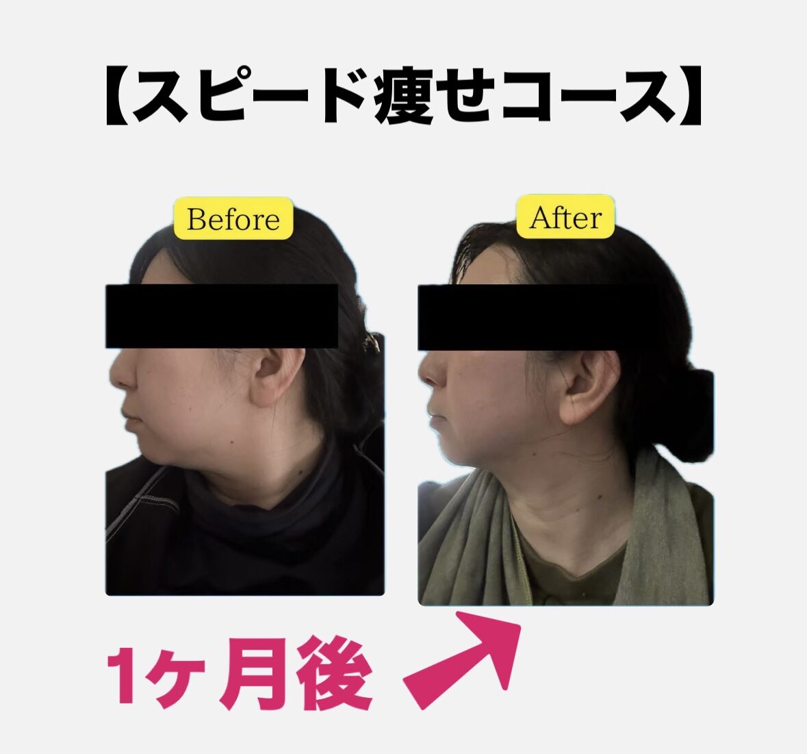 1ヶ月☆スピード痩せコースの変化