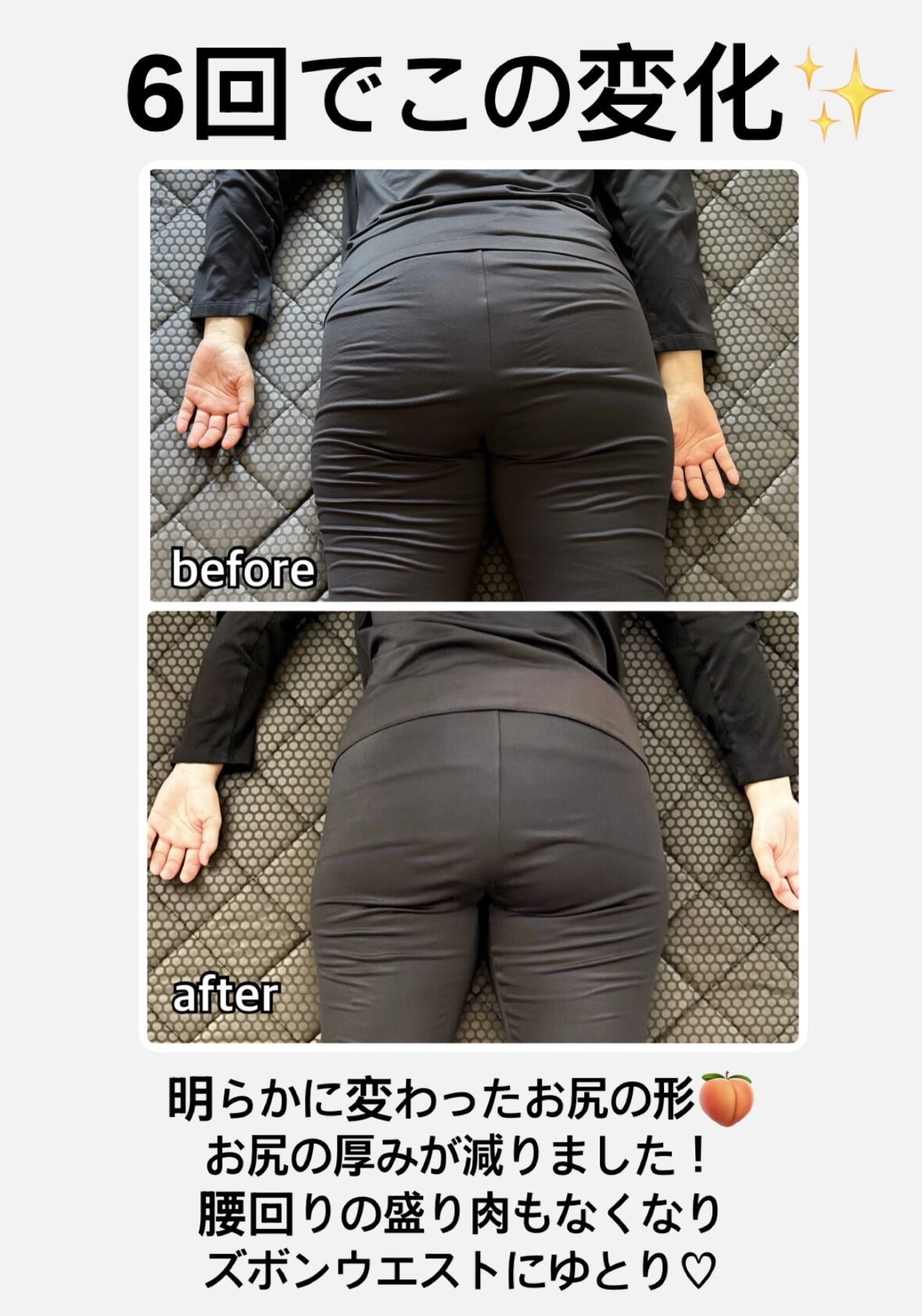 【50代】下半身が痩せたい！6回でこの変化✨明らかに変わった♪